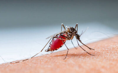 Home Remedy to Stop Mosquito Bite Itches